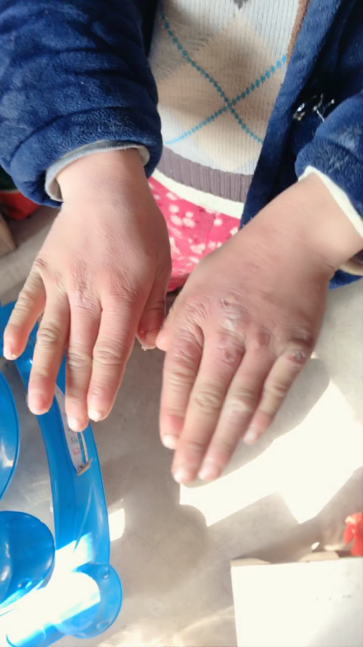 应该说是不听话.天冷老是往外跑,奶奶也看不住