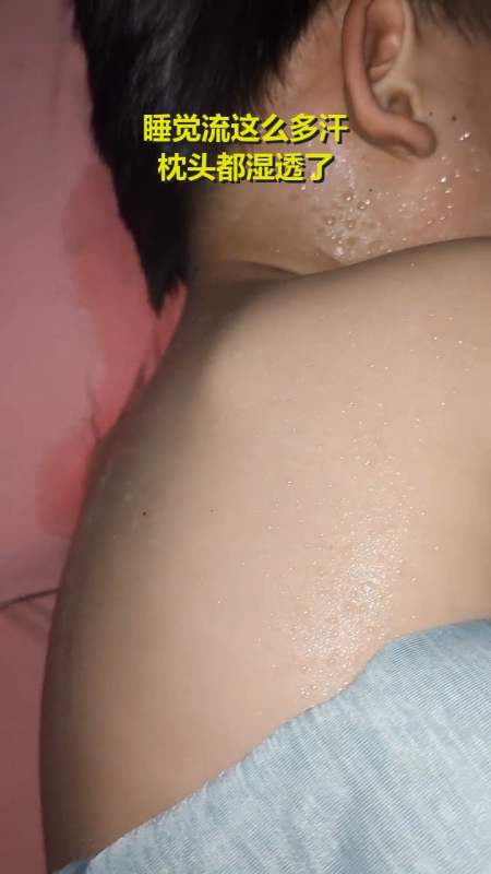 睡觉流这么多汗,枕头都湿透了?-度小视