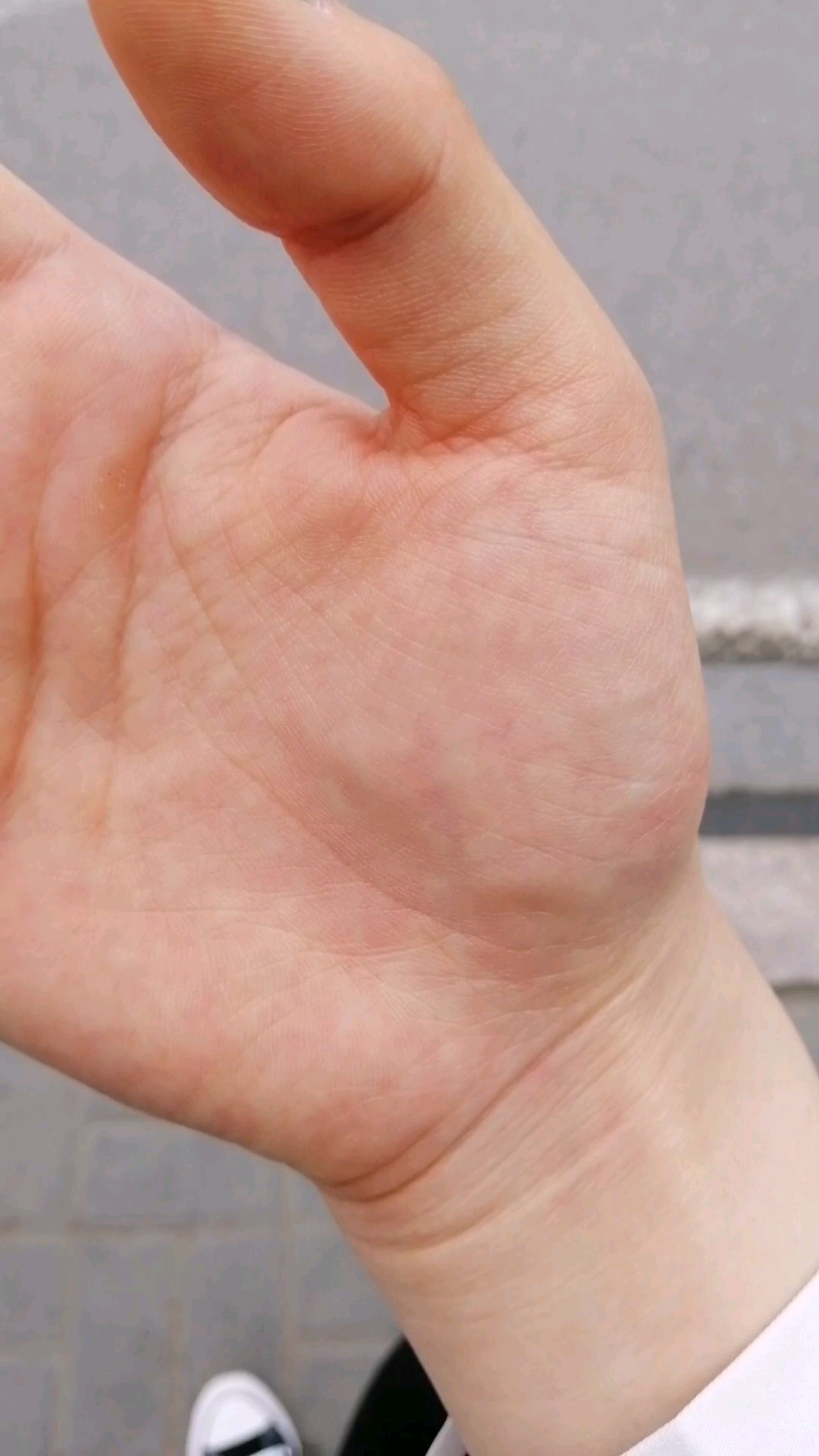 手掌血管起来了是什么感觉 练臀可以把手整肿了 疼