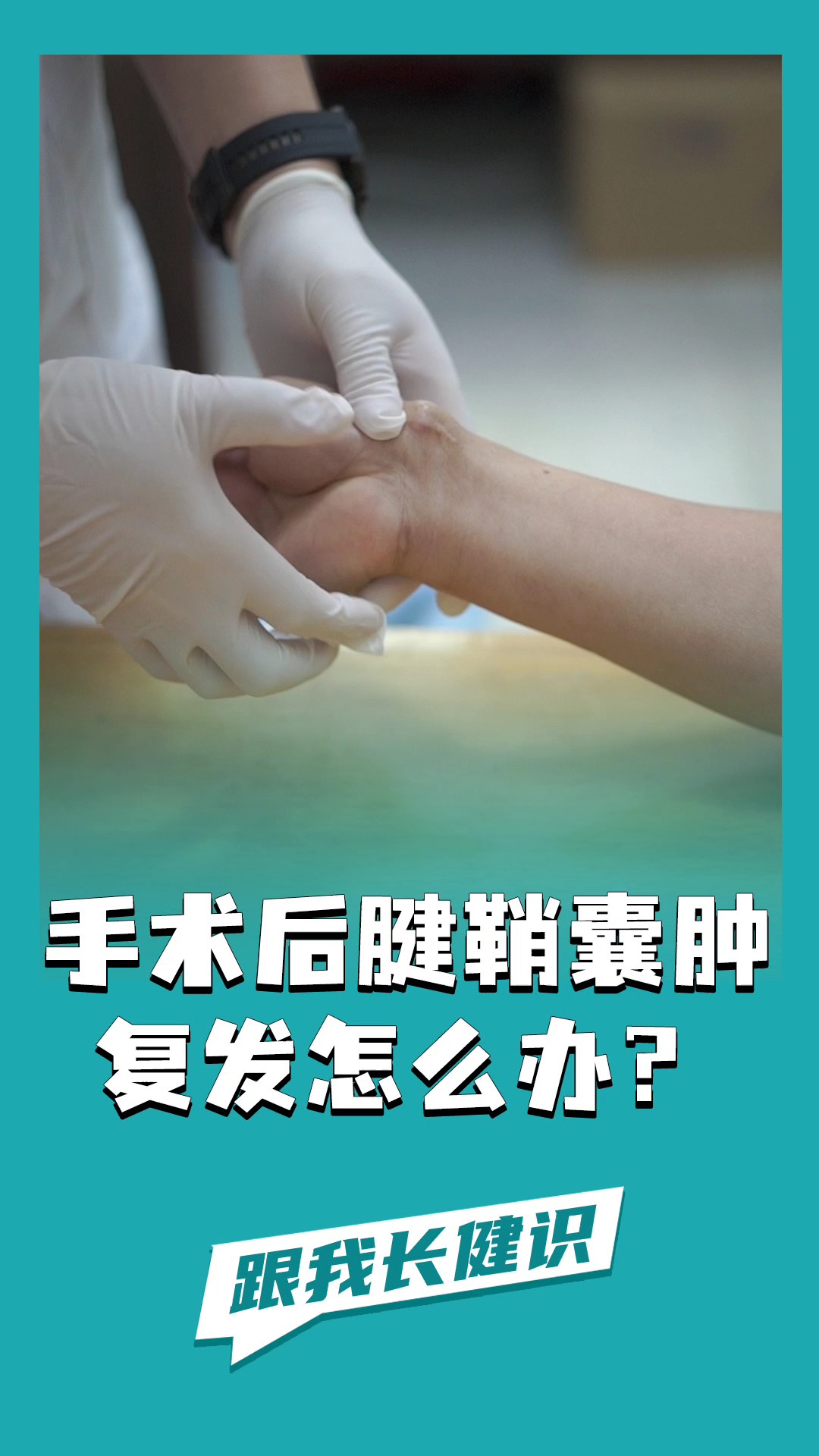 做了手術,腱鞘囊腫又復發了?