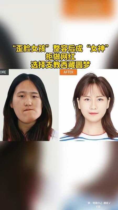 "歪脸女孩"整容后成"女神",拒做网红,选择支教西藏圆梦!正能量