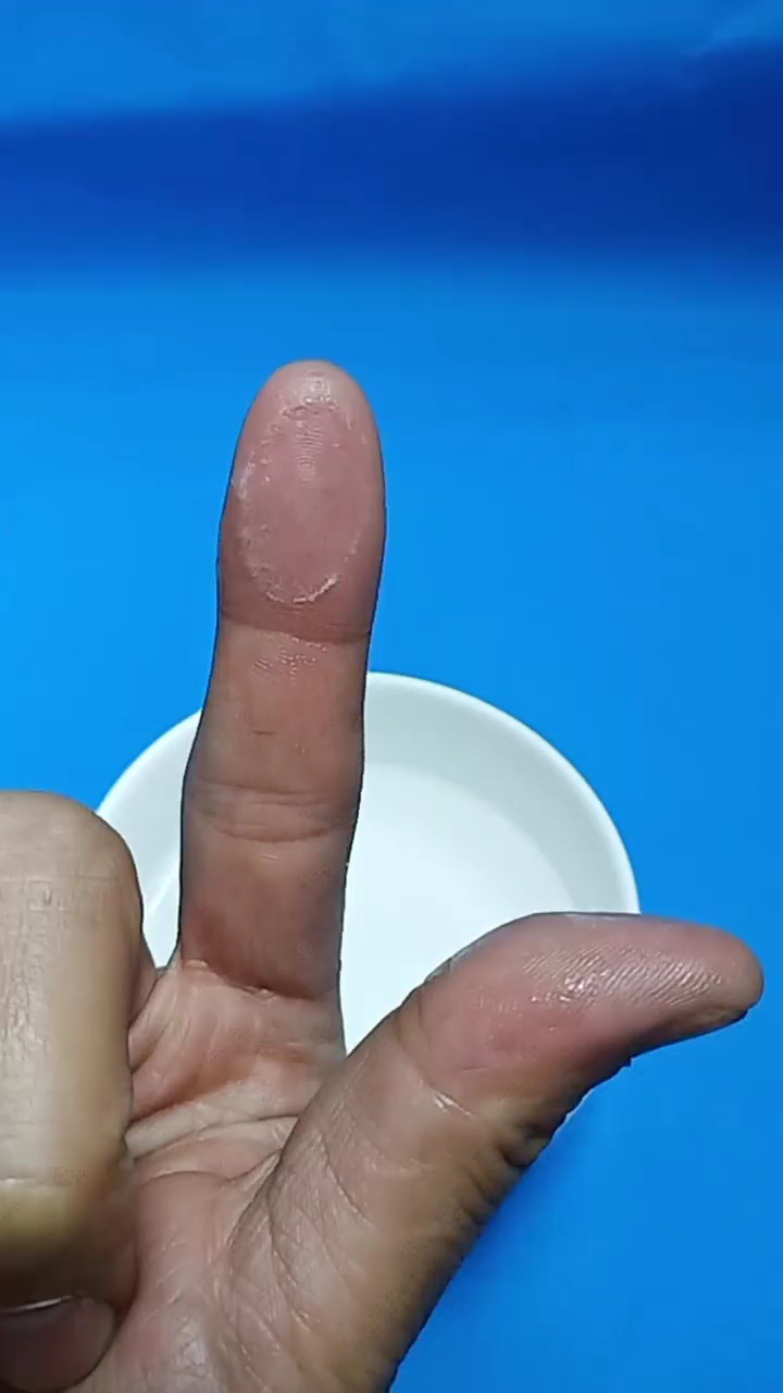 粘鞋不小心被胶水给粘住了怎么办?