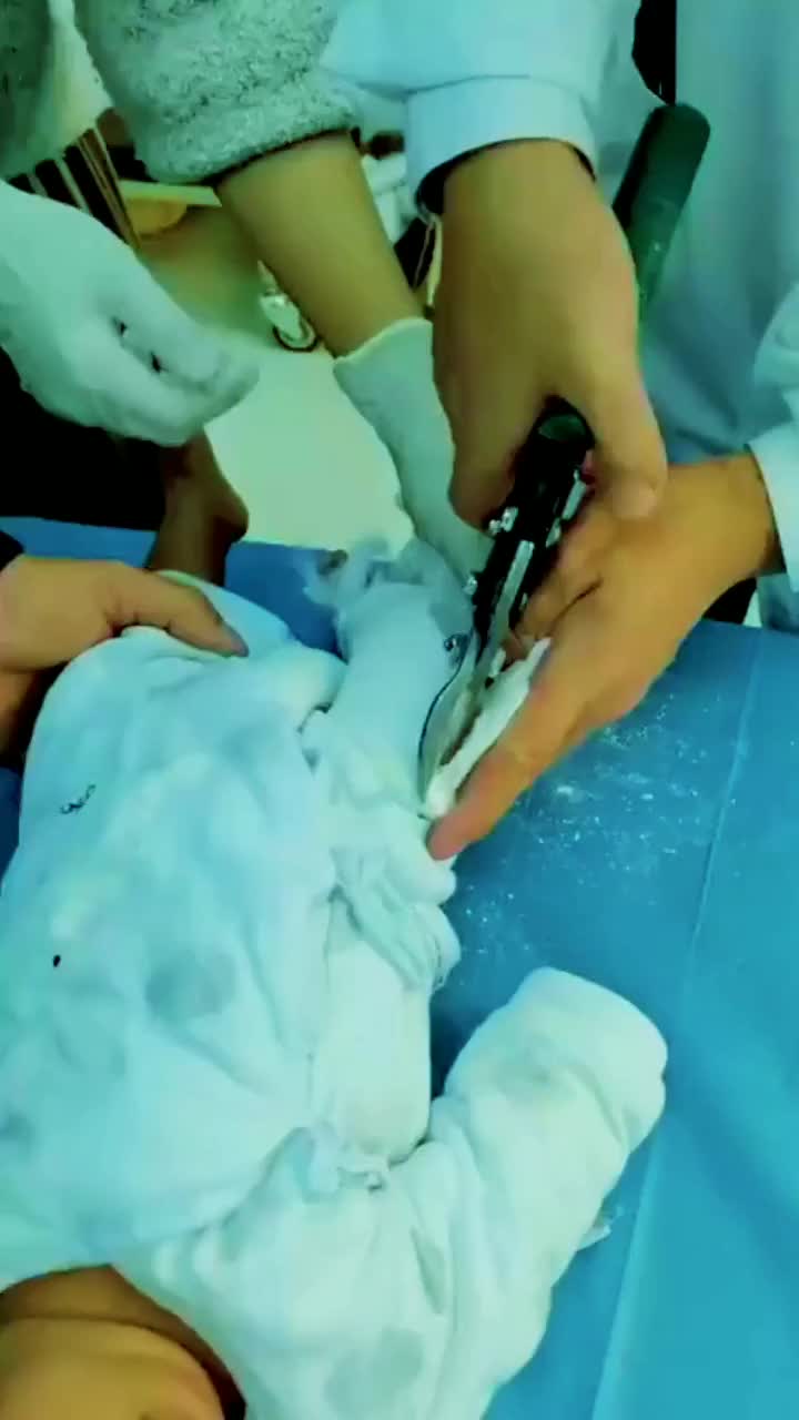 头次见宝宝拆石膏,这场面,估计这辈子都见不到第二次!