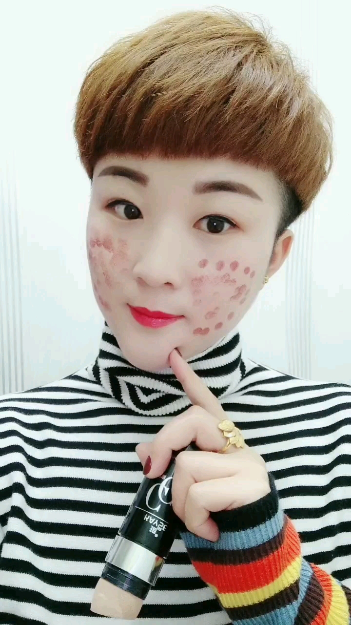 满脸麻子怎么办