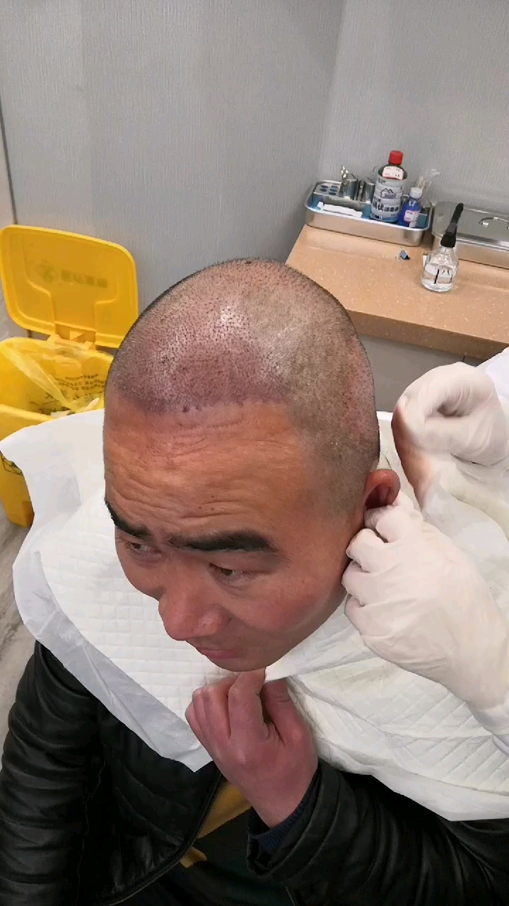 种发第二天,看着害怕,其实一点都不疼的.从此告别单身和自卑!