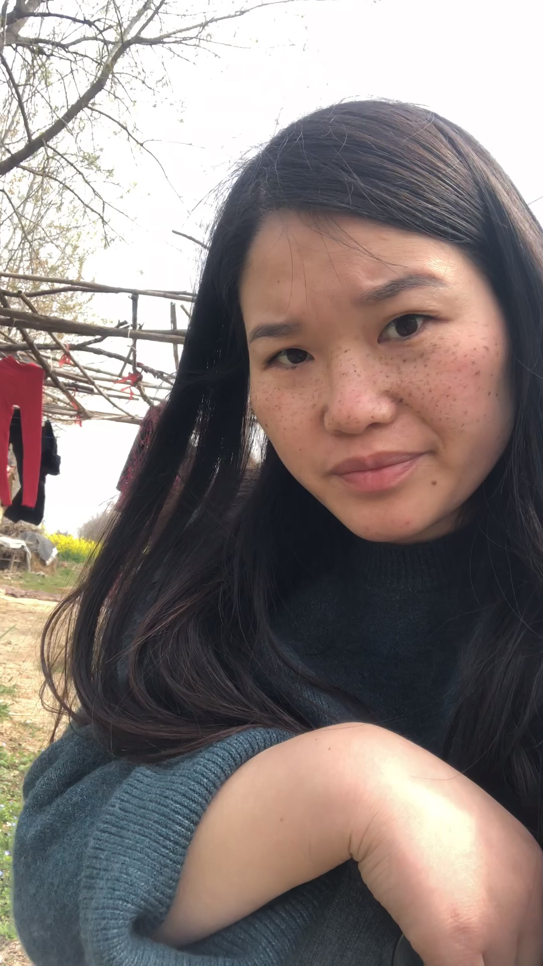 八年婚姻,六年麻子脸,两个月的改变.感谢你当年的嫌弃之恩#美白淡班