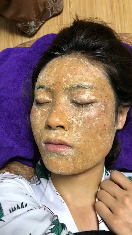 凌晨五点半,给四川美女排完斑毒.