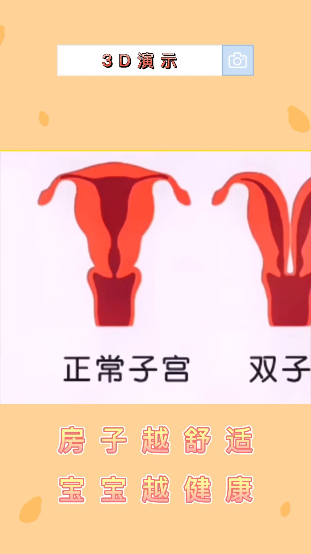 关爱女性健康3d演示子宫健康与否的差别