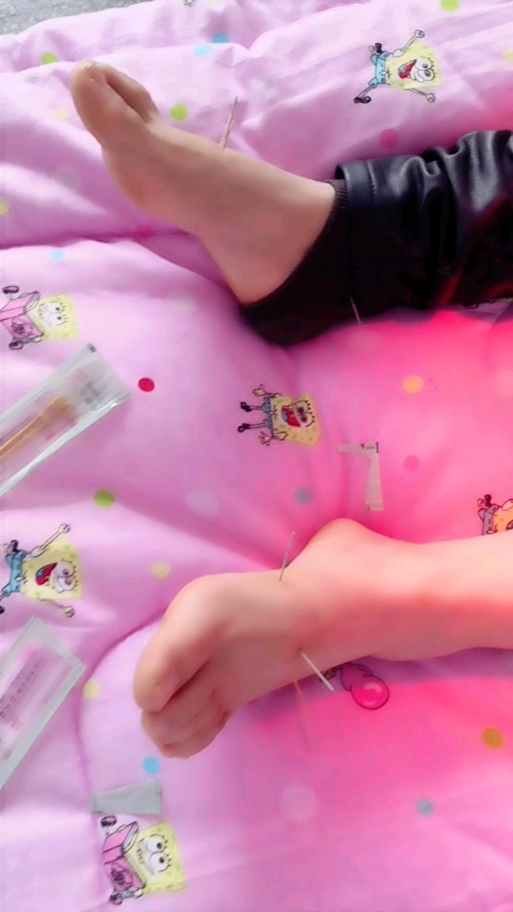 全民小助手 足针疗法治面肌痉挛