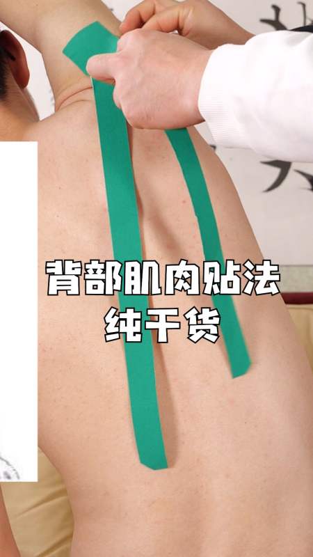 健身背阔肌菱形肌大圆肌贴法教学