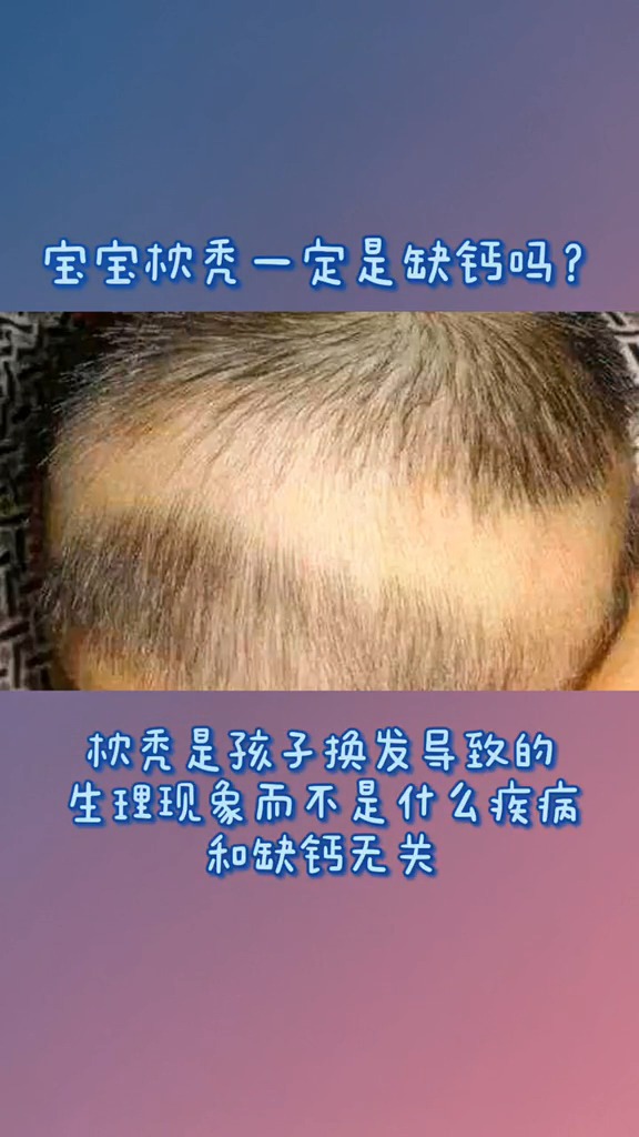 no!枕秃与缺钙并没有必然的联系!