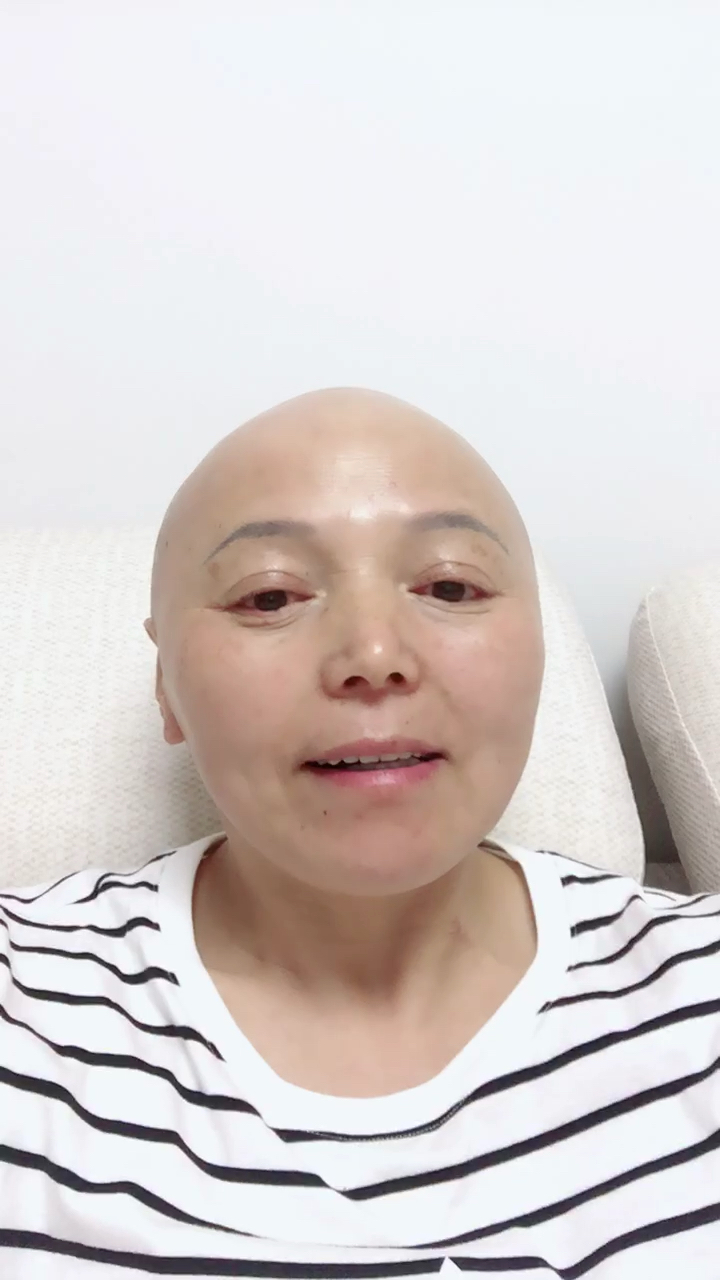 今天是化疗后掉头发的第一天,索性全剃掉,用全新的方式迎接新的挑战.