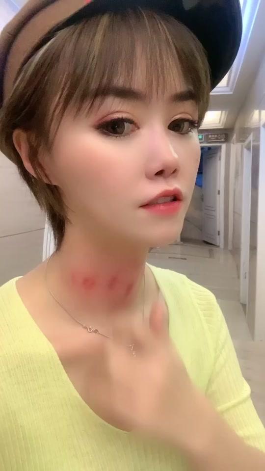 今天逛商场很多人都盯着我的脖子看,喉咙疼刮痧有错吗!