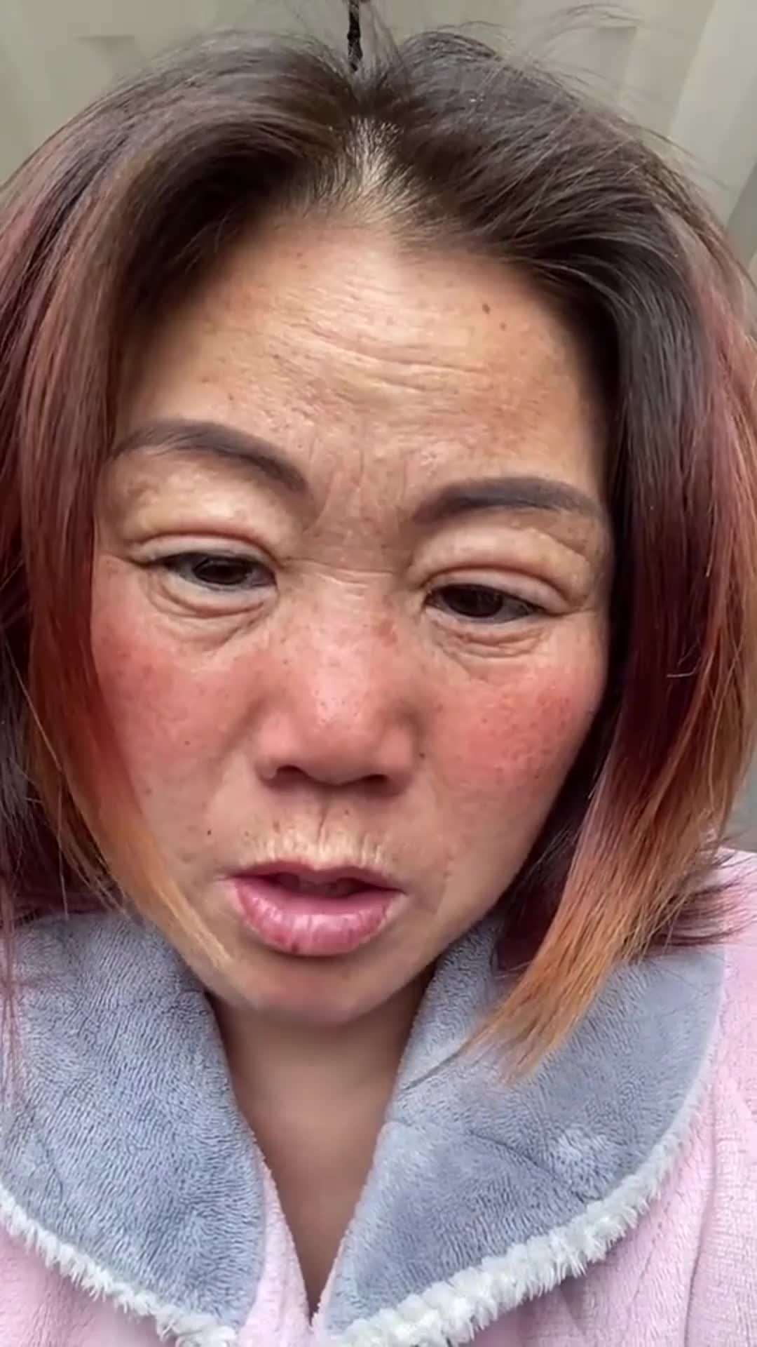 见识下整容失败的下场,这样一张脸,把我看愣住了!