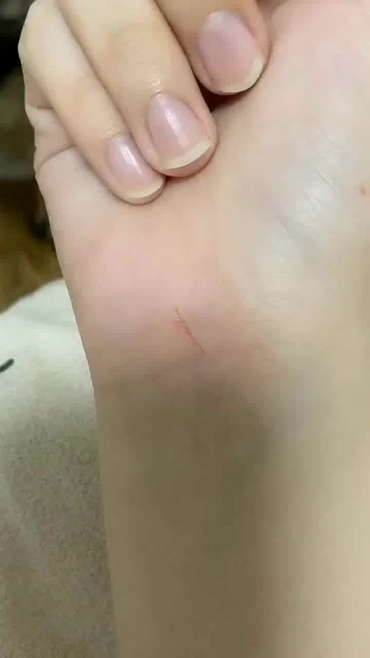 刚才被狗狗抓破了,有点担心,这要不要去打疫苗