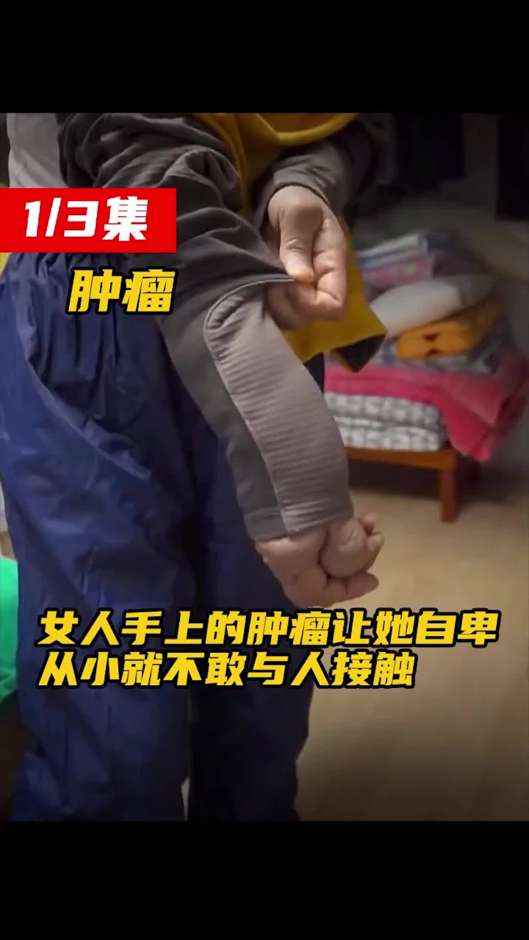 女人手上的肿瘤让她自卑,从小就不敢与人接触