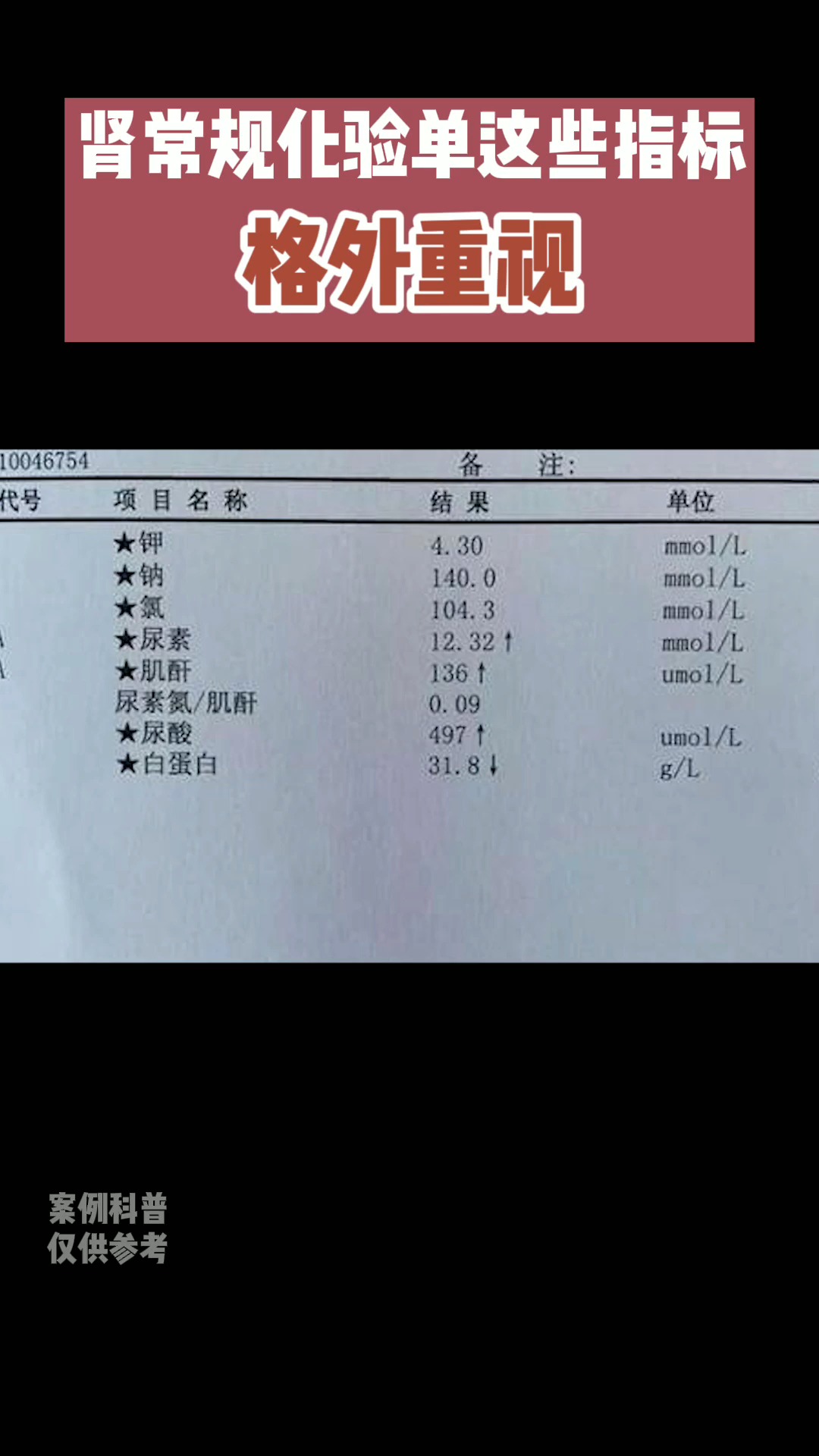 判断肾功能怎么样,这3个指标很关键-度小视