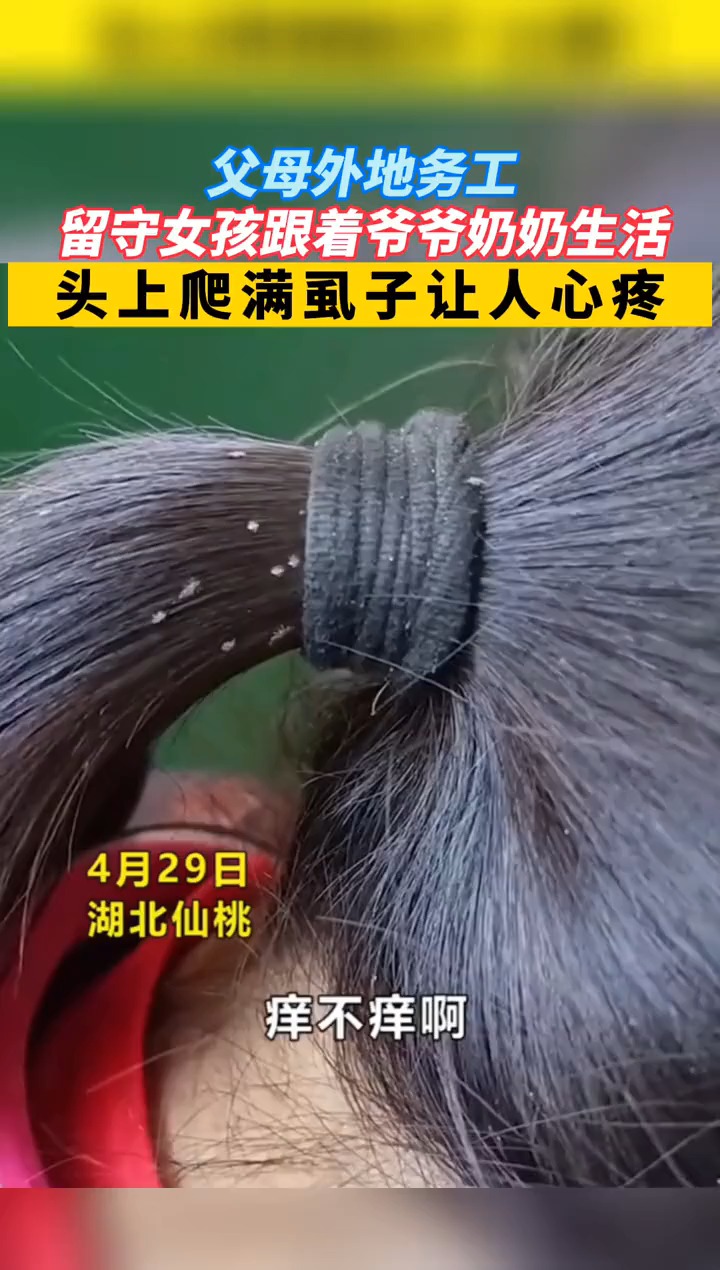 父母在外务工,留守女孩不会照顾自己,头上爬满虱子让人心疼.