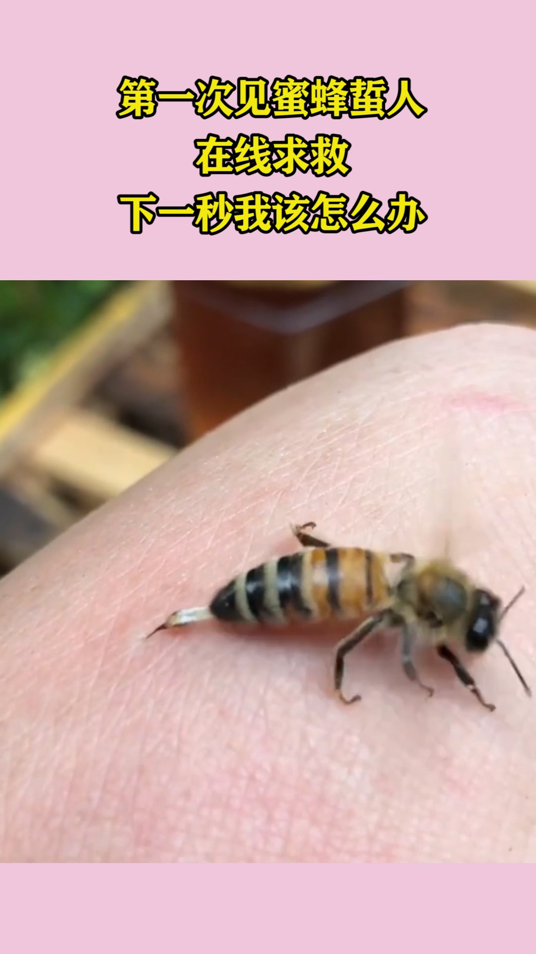第一次见蜜蜂蜇人,在线求救,下一秒我该怎么办!