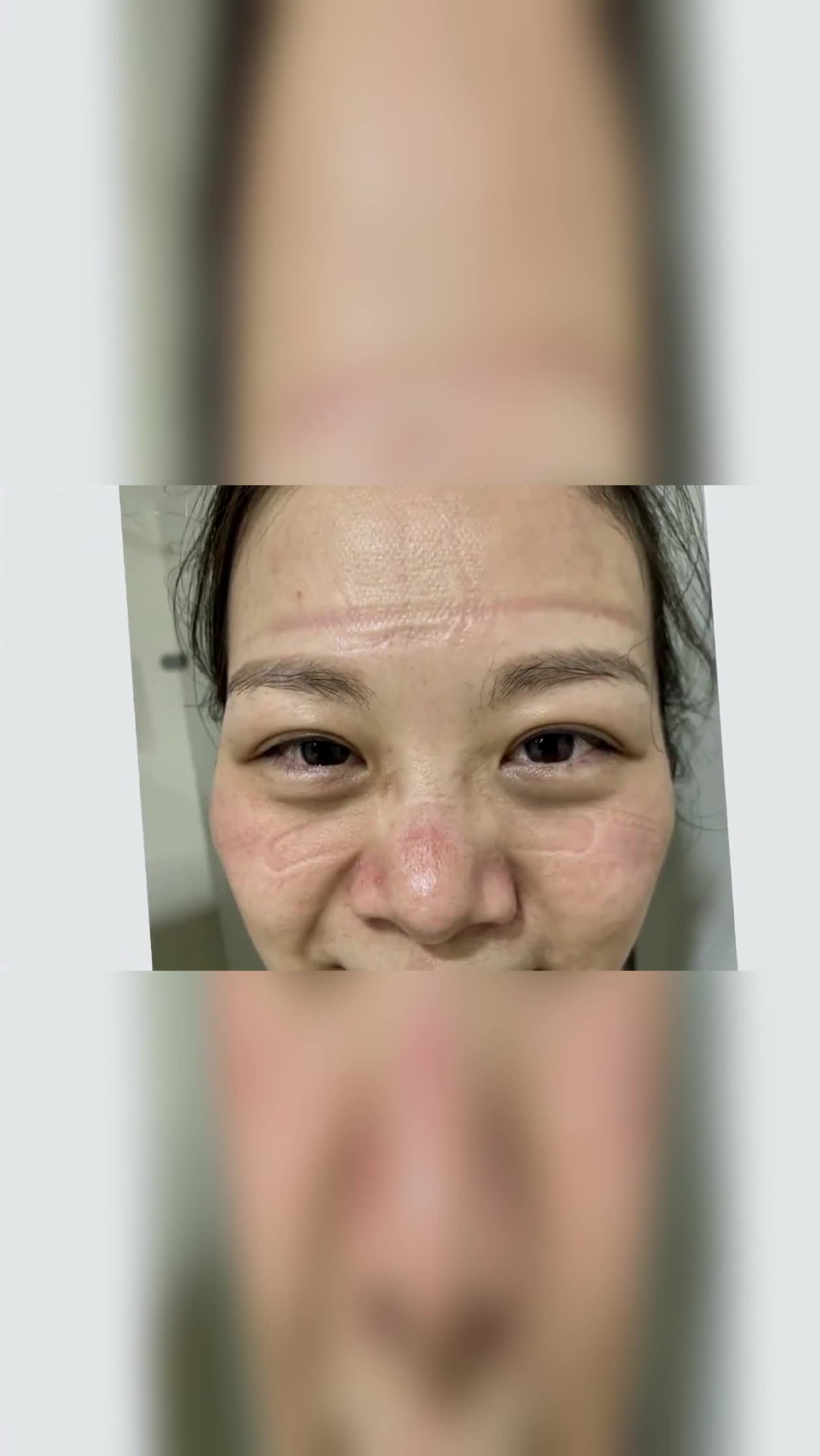 勒痕满满的脸颊,这是你们最美的印记,唯有致敬,感谢奋战在一线的护士