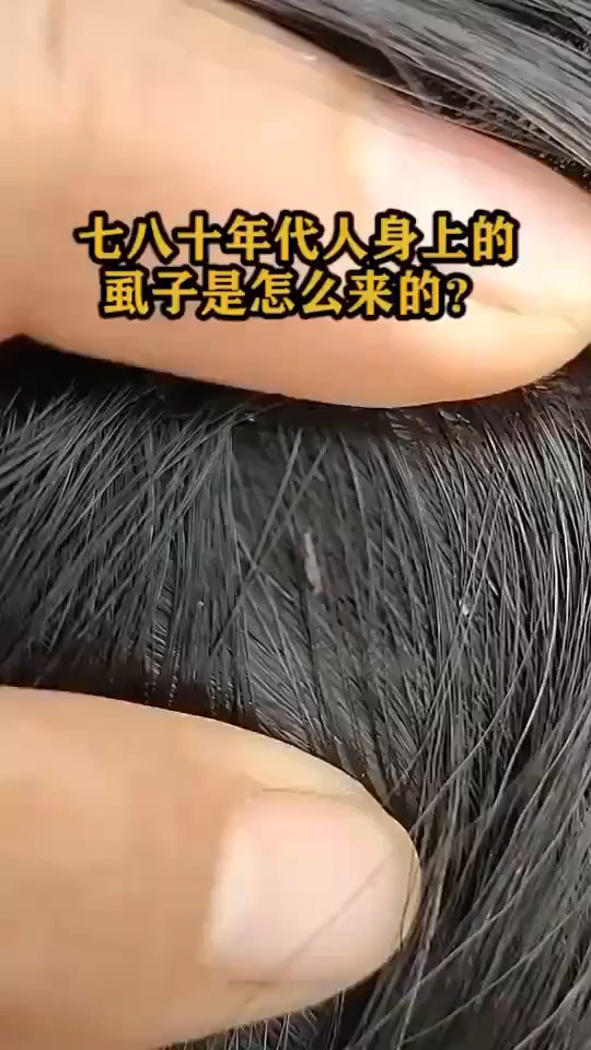 七八十年代人身上的虱子是怎么来的