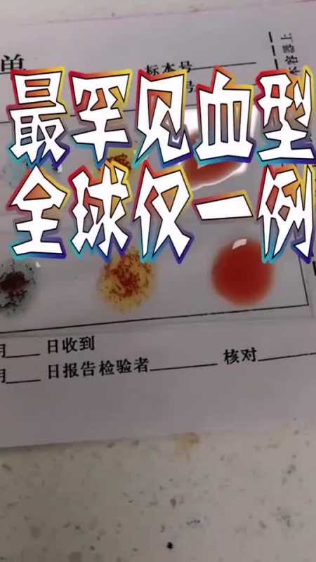 最罕见的血型,全球仅一例比熊猫血还珍贵