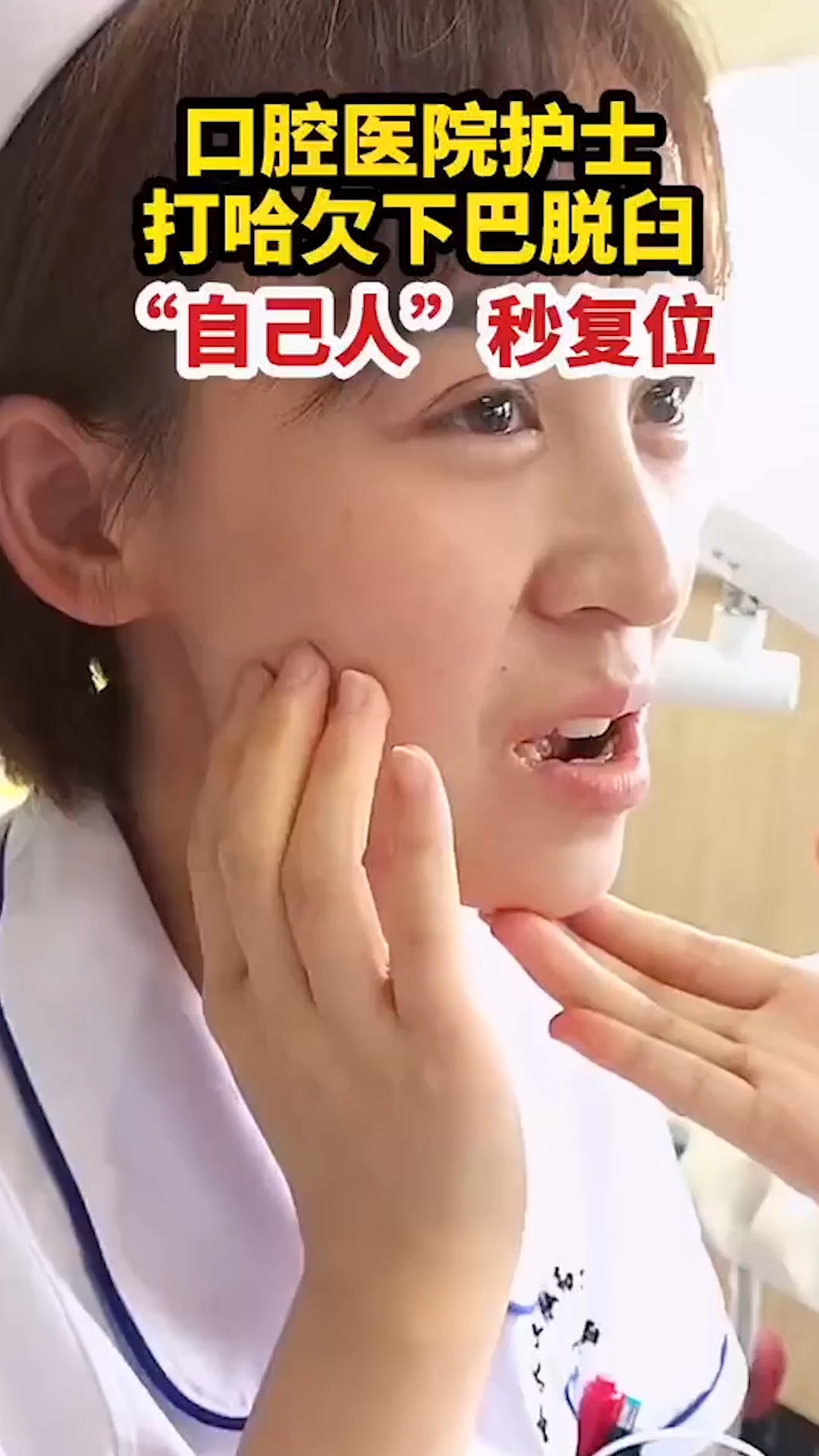 支持全民小视频#口腔医院护士,打哈欠下巴脱臼,自己人 秒复位
