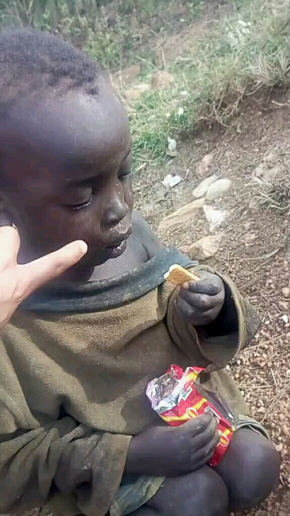 孩子营养不良,多虚弱啊