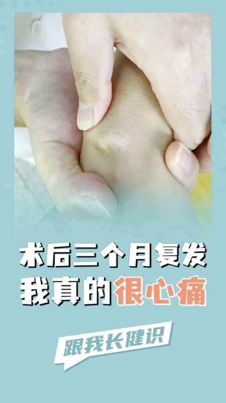 腱鞘囊腫手術複發率高,因此更應該遵照教科書的階梯治療原則,而不是一