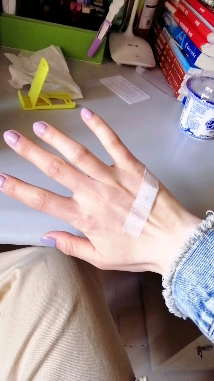 输完液手已经成这样了