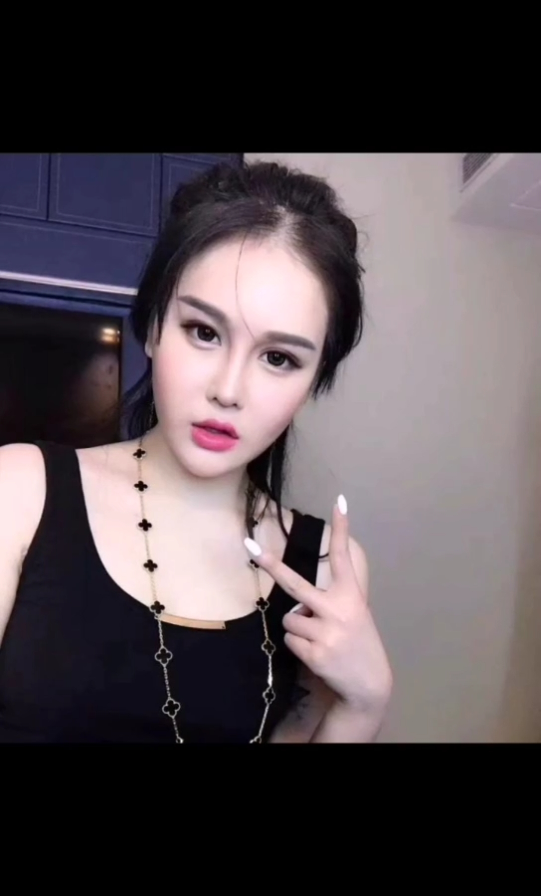 你喜欢的样子我都有#62岁赵本山23岁女儿球球,整容后长这样