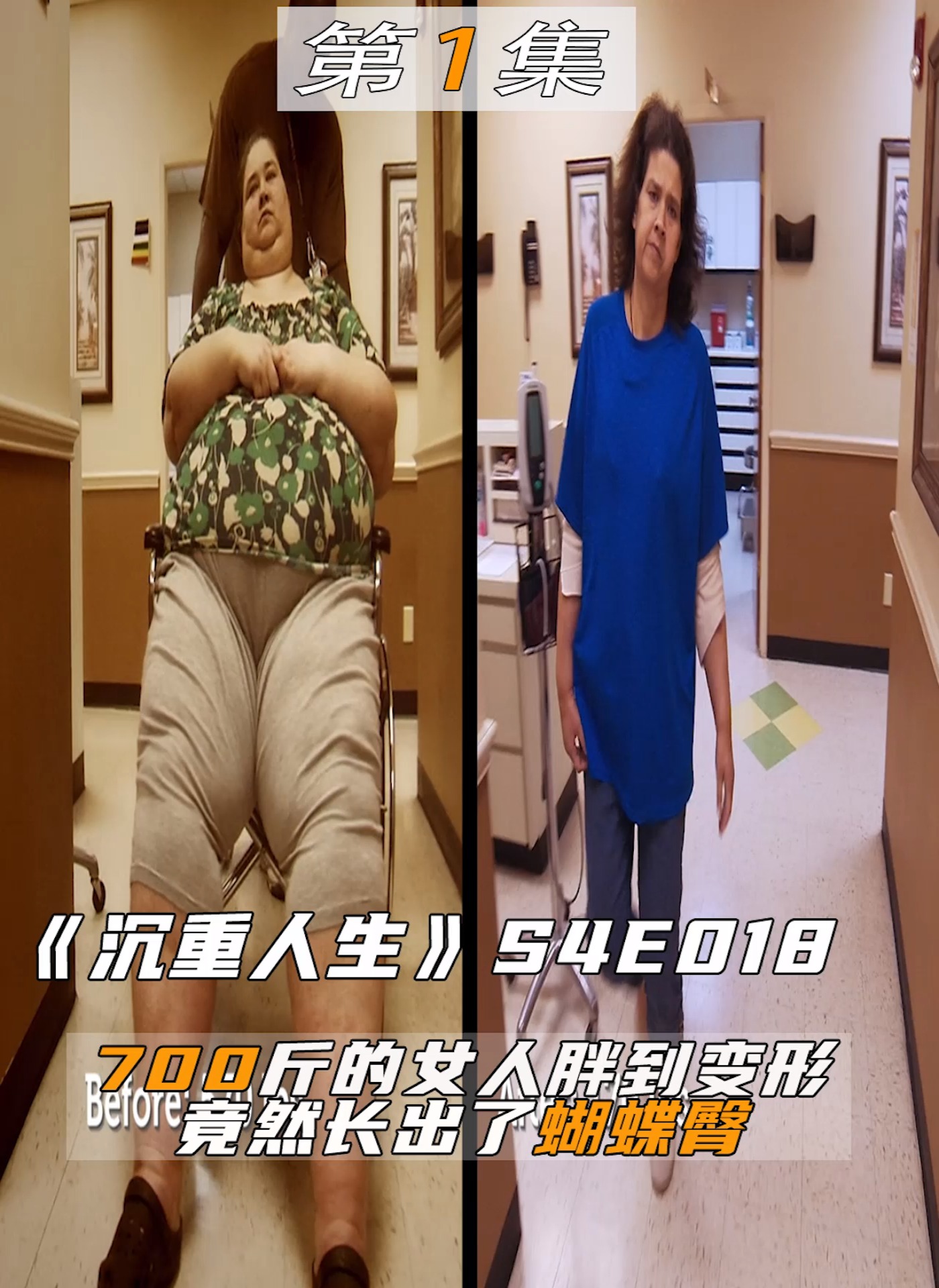 女人700斤胖子图片