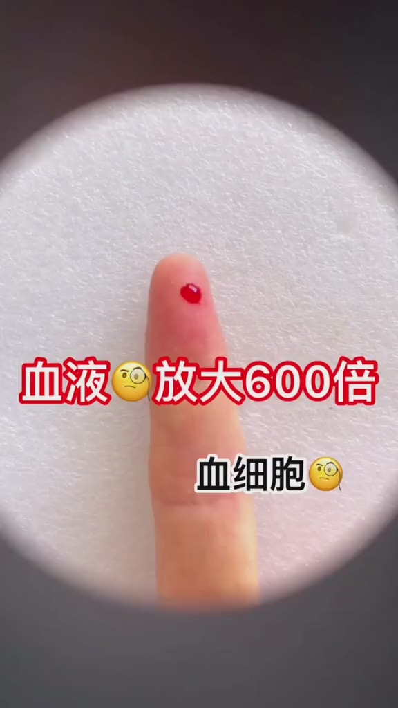 血液放大600倍第一次见竟然这么神奇
