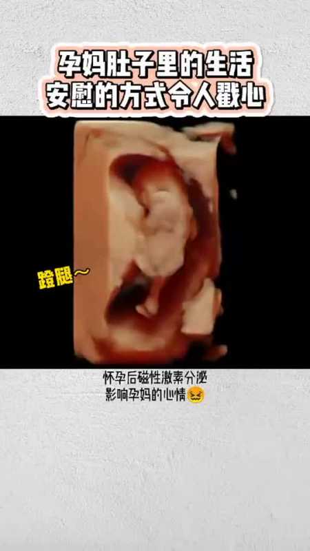 胎儿真的会"记仇",准爸爸要爱护孕妈妈哦～#四维彩超