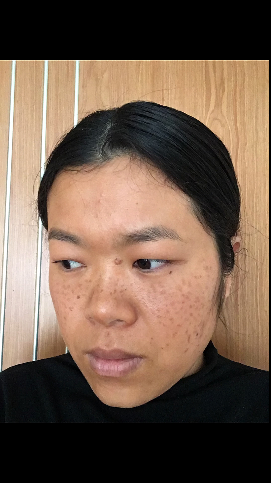 我要上热门#八年婚姻,六年麻子脸,两个月的改变,感谢你当年嫌弃之恩