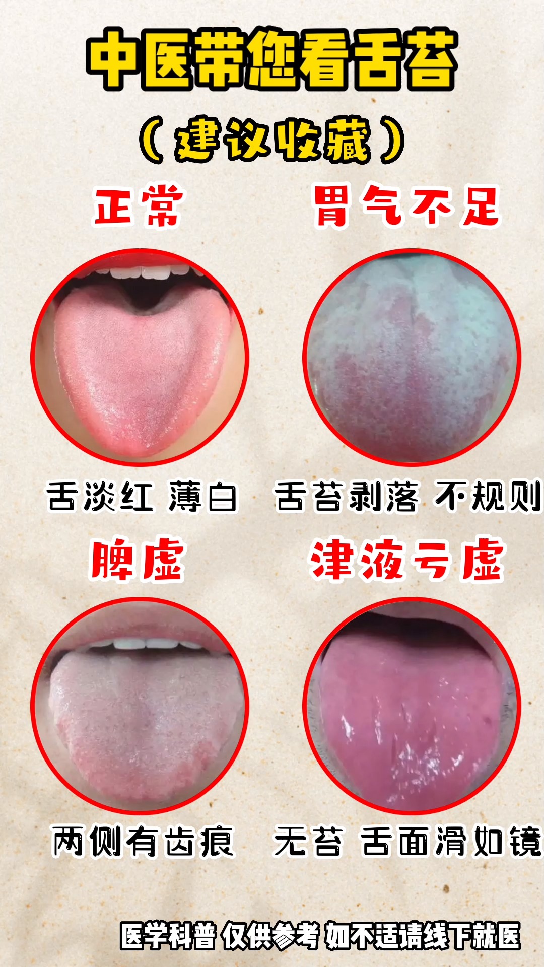 中医带您看舌苔