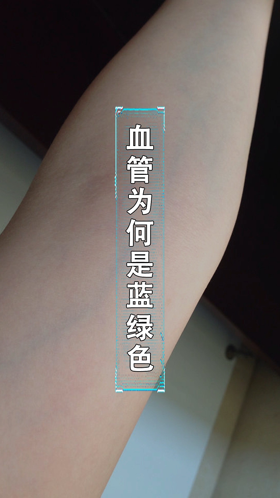 每天一点冷知识血明明是红色可为何血管呈现的是蓝绿色