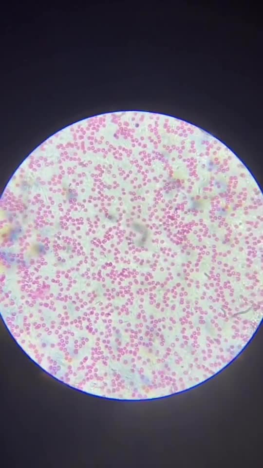 血液放大100倍,大家猜猜能看到什么