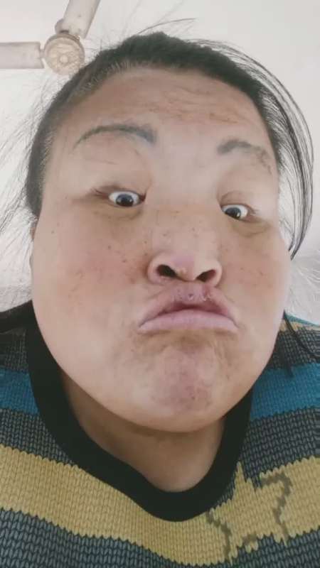 把美颜关上好丑啊太丑了脸上的黑点点都暴露了嘴上和鼻子上的小痘痘都