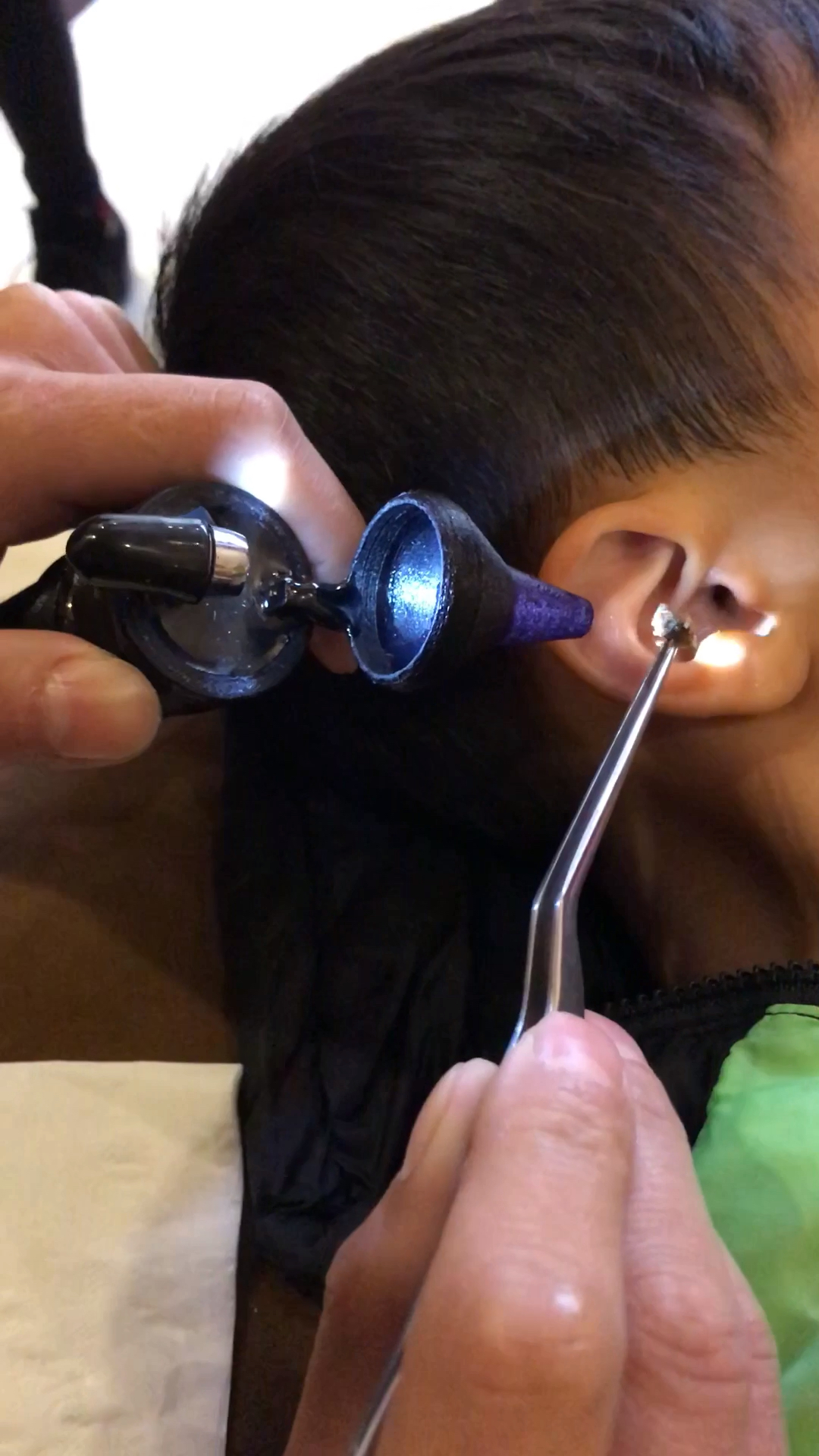 专业无痛取耳结,戎腾耳艺期待您的光临