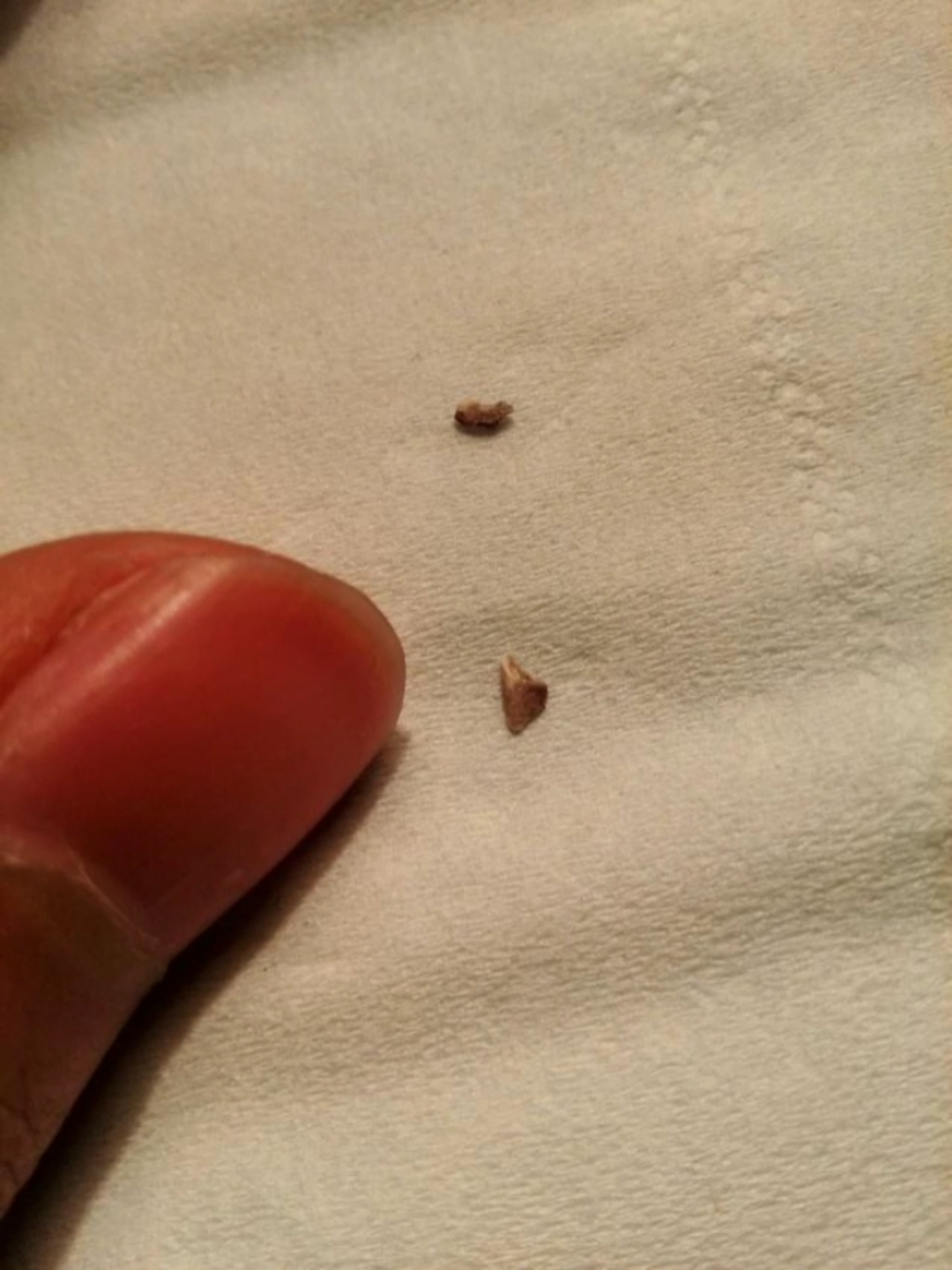 就用了一盒,就一盒,牙结石掉了这么多,牙龈出血好了,口臭没了,更重要