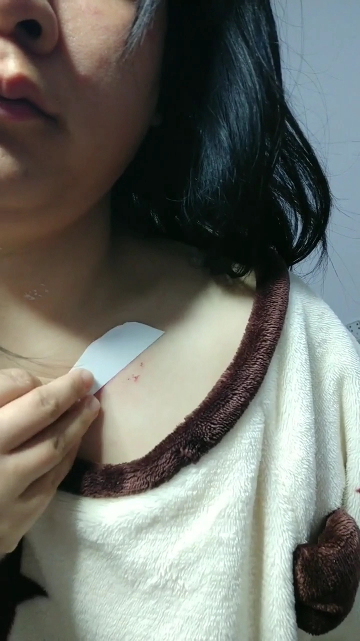 愚人节整蛊秘籍#遮疤神器