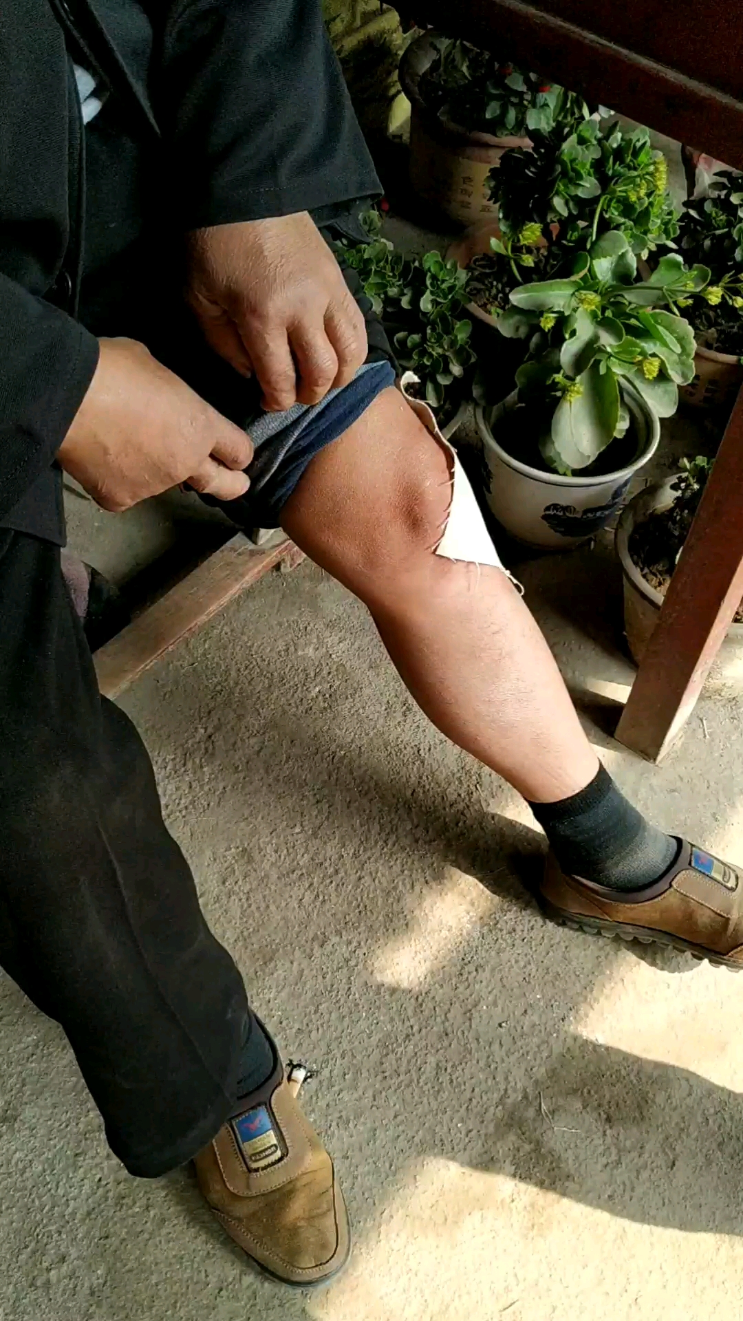 膝关节疼痛,贴膏药