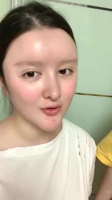 整容女满脸玻尿酸,老公还这么宠她,恕我直言,真重口味!