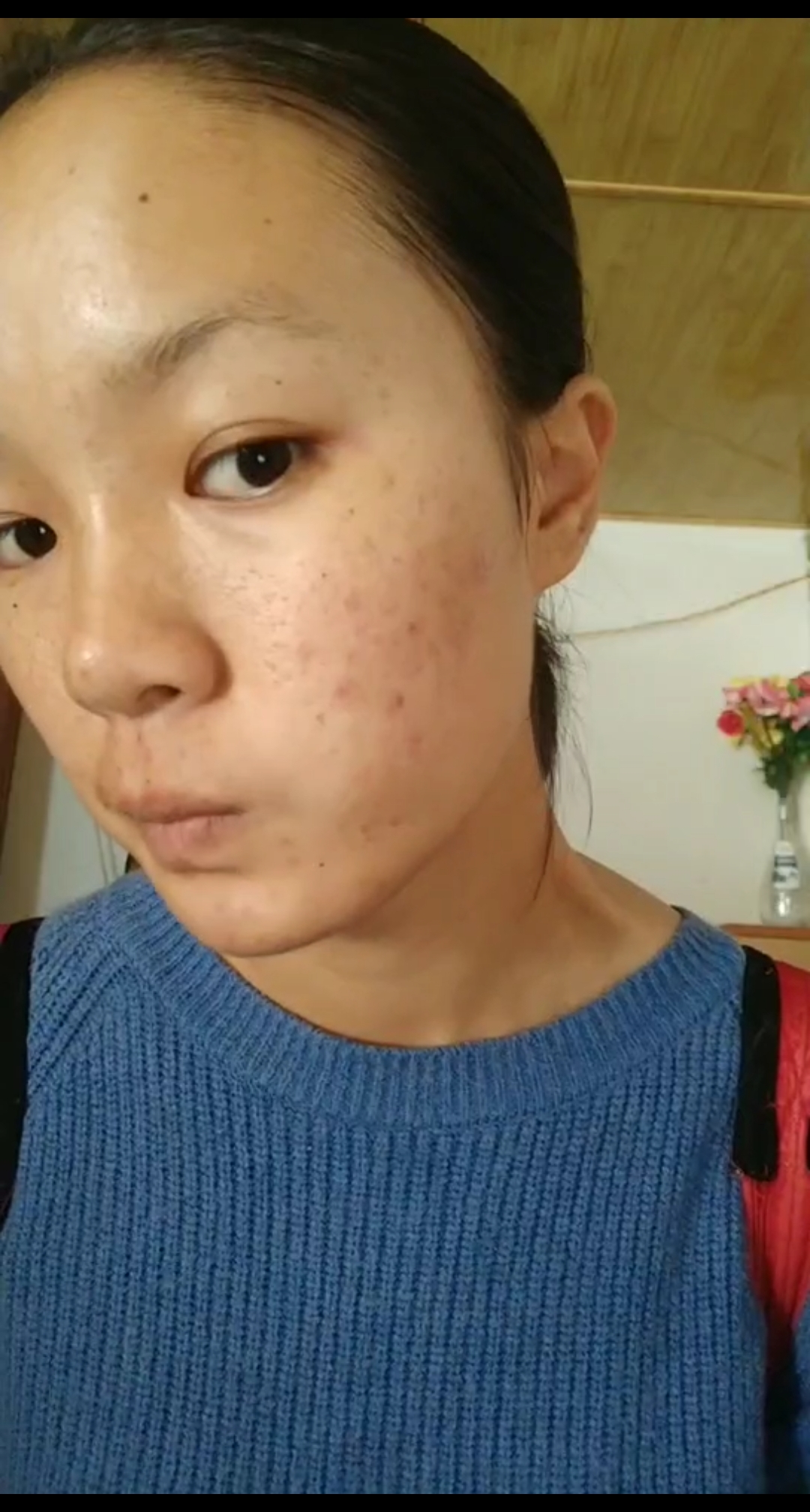 瑕疵脸的救星,有了它我也可以出去撩男神了