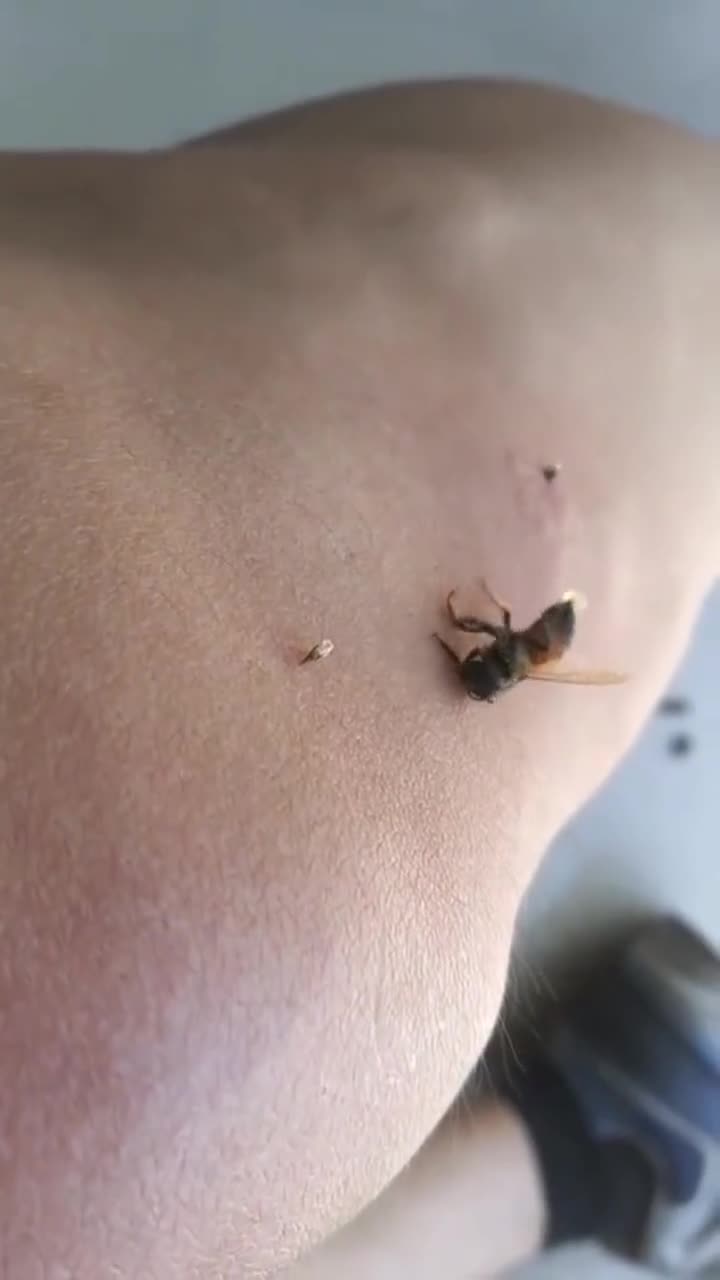 蜜蜂放出蜂针,自己很痛苦,我也很痛!