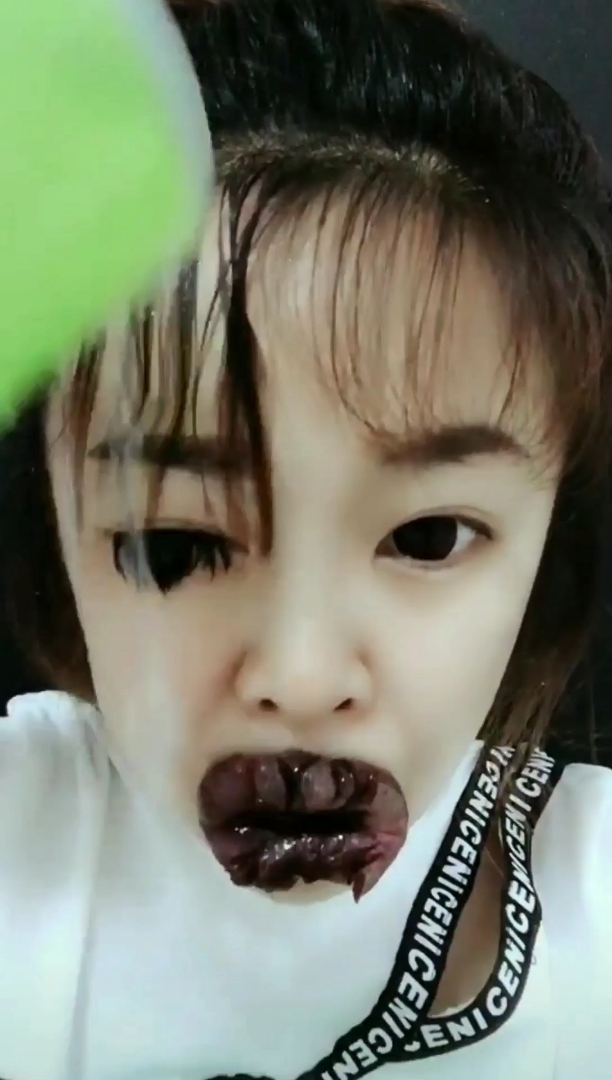 整失败的大嘴巴子