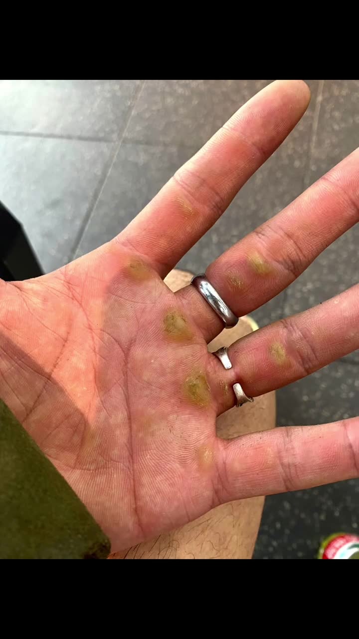 练那么久了就手上的训练痕迹最明显