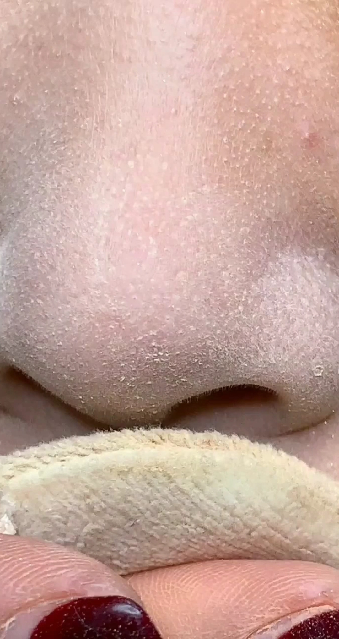 支持全民正能量#浮粉卡粉太严重,不敢参加同学聚会