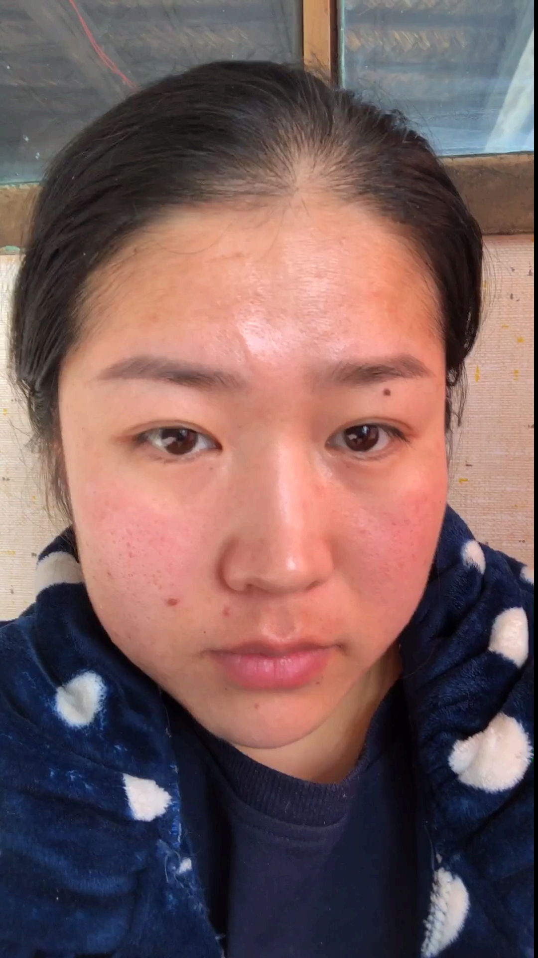 我要变好看#有同款的脸么?一遇冷空气,就变成大红脸了